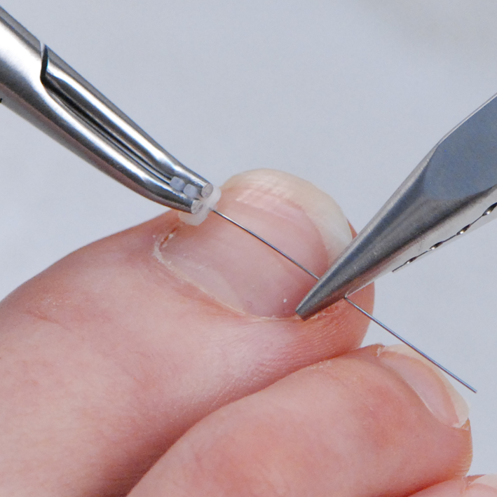 Nagelkorrekturspange
